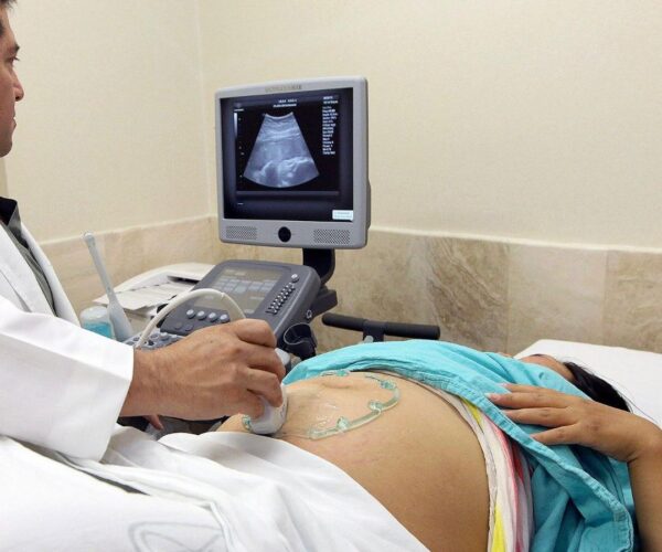 IMSS COMPROMETIDO CON LA SALUD MENTAL