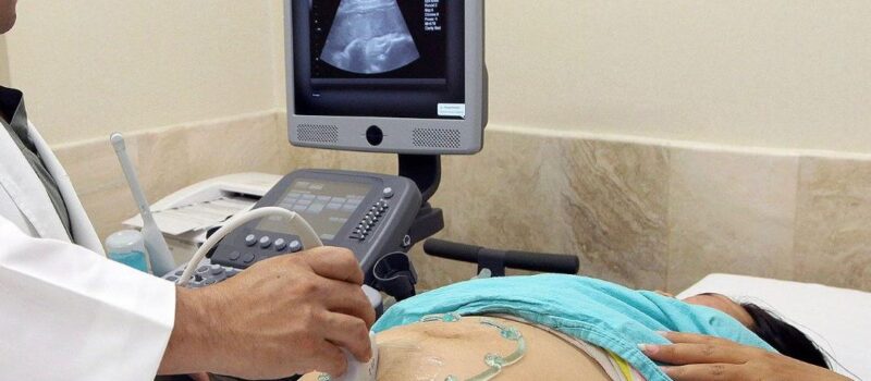IMSS COMPROMETIDO CON LA SALUD MENTAL